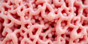 Healthy pancreas with insulin cells